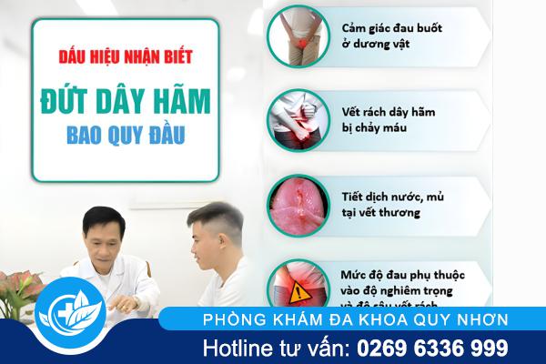 Đứt Dây Hãm Bao Quy Đầu – Nguy Cơ Viêm Nhiễm Và Rối Loạn Chức Năng Sinh Lý