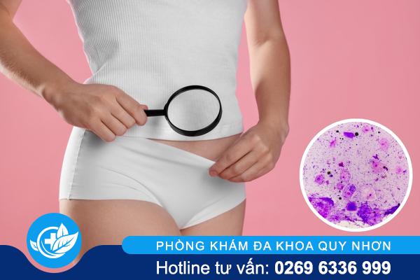 Nấm sinh dục: Một căn bệnh “thầm lặng” phá hủy sức khỏe vùng kín