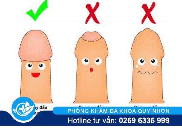 Cắt bao quy đầu là gì? Vì sao cần cắt bao quy đầu?