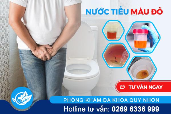 Nước tiểu có màu đỏ  – Dấu hiệu “đỏ” cảnh báo bệnh nam khoa nguy hiểm