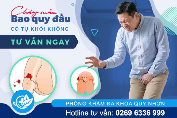 Chảy máu bao quy đầu có tự khỏi không? Những điều nam giới cần biết