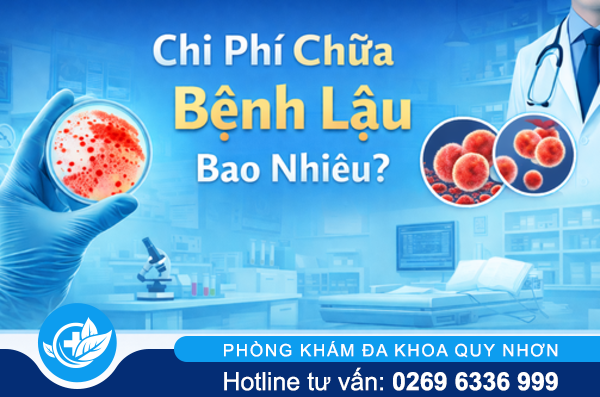 Chi phí chữa bệnh lậu hiện nay là bao nhiêu?