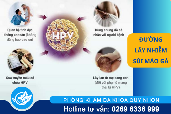 Sùi mào gà có lây không? Sự thật khiến nhiều người bất ngờ