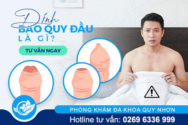 Nhận biết sớm dính bao quy đầu để tránh biến chứng nguy hiểm