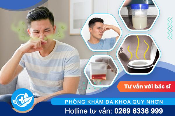 Nước tiểu có mùi bất thường: Đừng chủ quan với dấu hiệu này