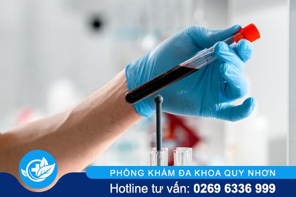 Các xét nghiệm giang mai hiện nay