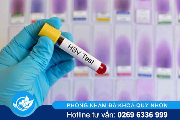 Xét nghiệm mụn rộp sinh dục ở đâu uy tín?