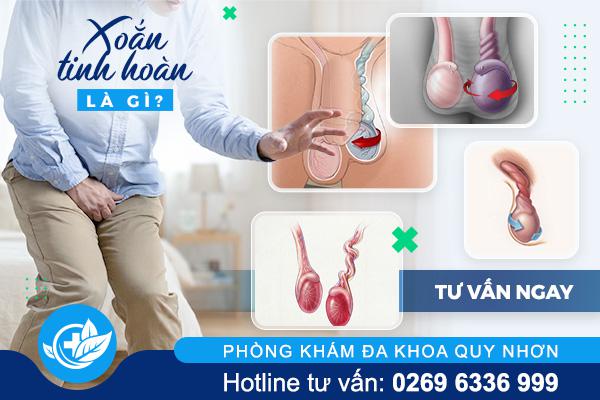 Xoắn tinh hoàn – Bệnh nam khoa cần cấp cứu kịp thời