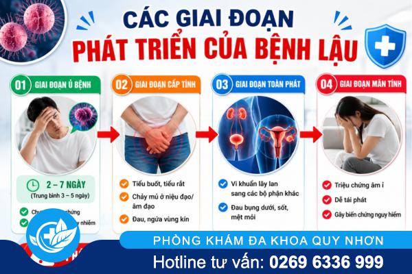 Từ âm thầm đến nguy hiểm: Các giai đoạn bệnh lậu bạn cần biết
