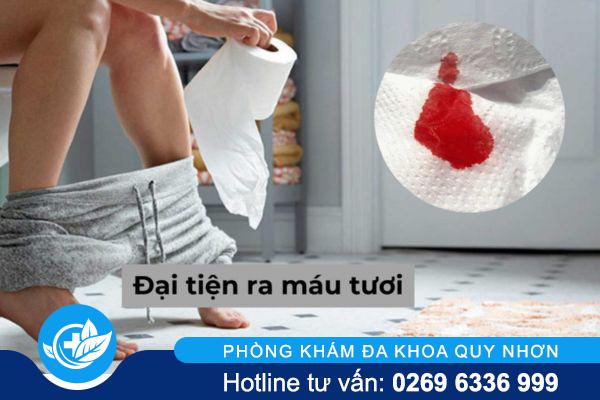 Đại tiện ra máu là dấu hiệu cảnh báo bệnh gì?