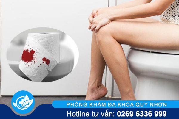 Trĩ chảy máu kéo dài – Cảnh báo biến chứng nguy hiểm