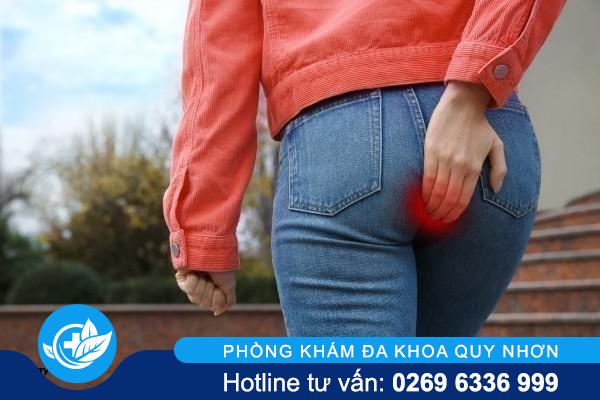 Nhiều người chủ quan với lở loét hậu môn và gặp biến chứng