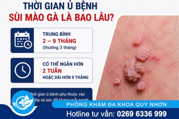 Hiểu rõ thời gian ủ bệnh sùi mào gà để phát hiện kịp thời