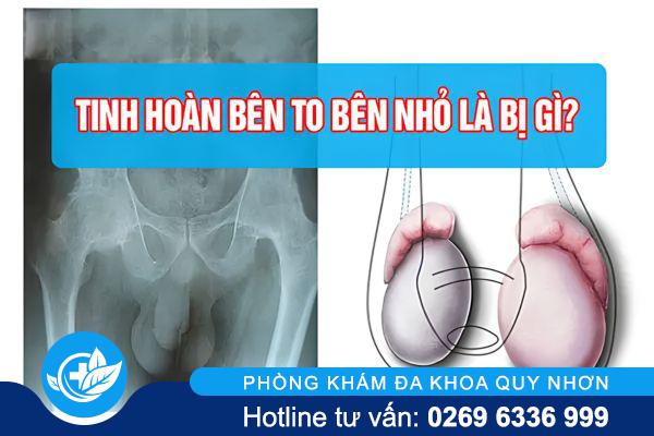 Tinh Hoàn To Nhỏ: Dấu Hiệu Bất Thường Nam Giới Cần Biết