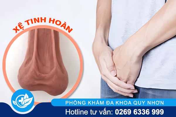 Vì sao bị xệ tinh hoàn? Những điều nam giới cần biết